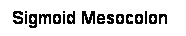 Cuadro de texto: Sigmoid Mesocolon
